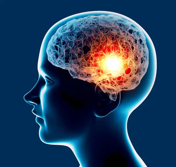 Neuro Rehab